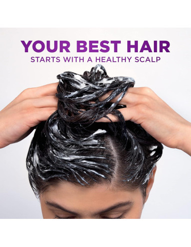 Acondicionador Anticaspa Scalp X Head & Shoulders 148 ml