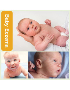 Crema para Bebés 100ml - Cuidado Erupciones por Calor y Sudor 2