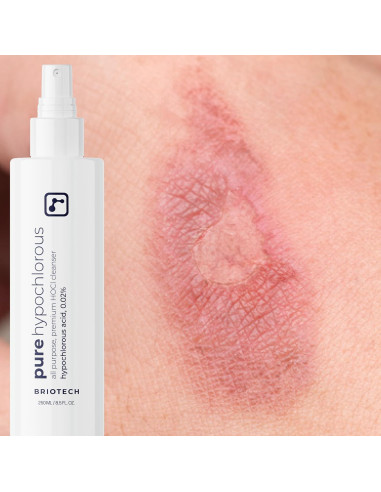 Spray Desinfectante Ácido Hipocloroso Puro Briotech 240 ml