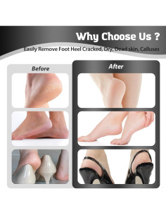 Removedor de Callos Eléctrico HsnChrm con 60 Discos de Lija 2