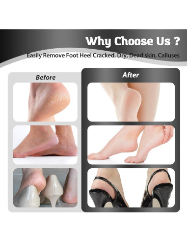 Removedor de Callos Eléctrico HsnChrm con 60 Discos de Lija