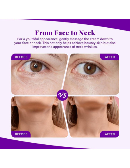 Crema Hidratante Facial ANAI RUI Bakuchiol 48g - Anti-Envejecimiento Crema Hidratante Facial ANAI RUI Bakuchiol 48g - Anti-Envejecimiento