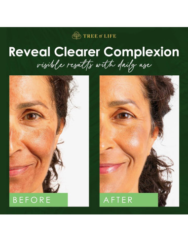 Suero de Niacinamida Tree of Life 59.15 ml - Hidratante Facial