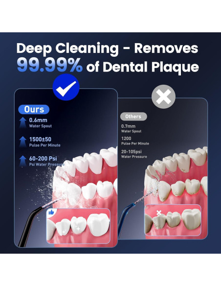 Irrigador Oral Inalámbrico JJC205 320ml 5 Modos Negro