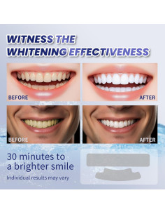 Tiras Blanqueadoras de Dientes Lanlwos 28 Unidades Sin Peróxido 2