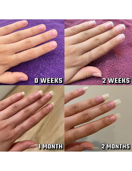 Aceite Endurecedor para Uñas Biaoyun - Crecimiento y Hidratación