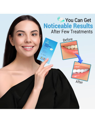 Tiras Blanqueadoras de Dientes Huzayl - 28 Tiras, Sin Peróxido