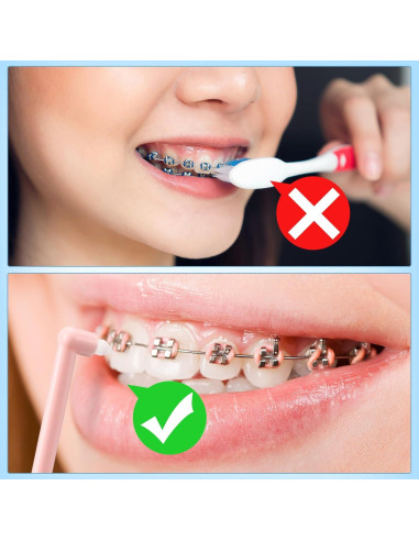 48 Cepillos de Dientes con Punta Final Qinyoung - Limpieza Detallada