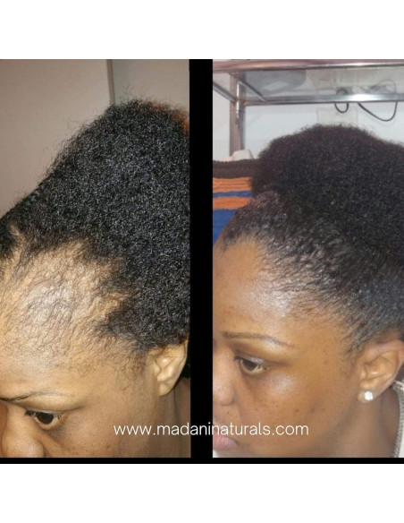 Aceite Estimulador del Crecimiento del Cabello Madani Naturals 59ml