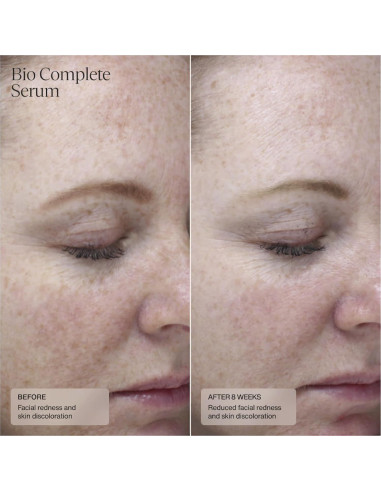 Suero de Retinoides Bio Senté 29.57 ml para Piel Sensible