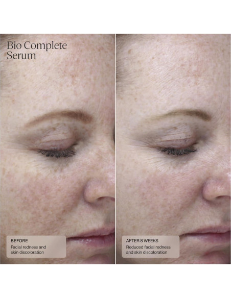 Suero de Retinoides Bio Senté 29.57 ml para Piel Sensible Suero de Retinoides Bio Senté 29.57 ml para Piel Sensible