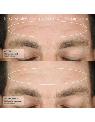 Suero de Retinoides Bio Senté 29.57 ml para Piel Sensible