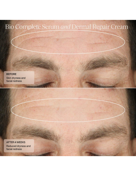 Suero de Retinoides Bio Senté 29.57 ml para Piel Sensible Suero de Retinoides Bio Senté 29.57 ml para Piel Sensible