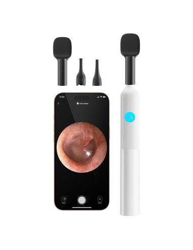 Kit de Examen ENT para Bebés OTTOLIVES con Cámara HD