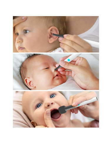 Kit de Examen ENT para Bebés OTTOLIVES con Cámara HD