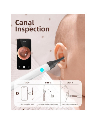 Kit de Examen ENT para Bebés OTTOLIVES con Cámara HD