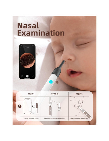 Kit de Examen ENT para Bebés OTTOLIVES con Cámara HD