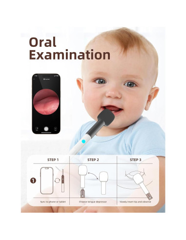 Kit de Examen ENT para Bebés OTTOLIVES con Cámara HD