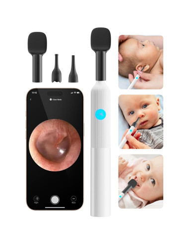 Kit de Examen ENT para Bebés OTTOLIVES con Cámara HD