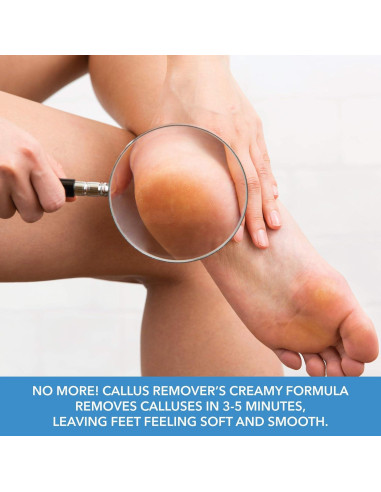 Removedor de Callos ForPro 32 oz. Fórmula Hidratante Rápida