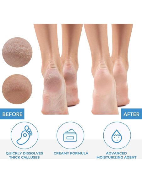Removedor de Callos ForPro 32 oz. Fórmula Hidratante Rápida