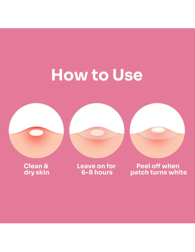 Parche de Acné Hidrocoloide Conkote Grande - 5 Unidades