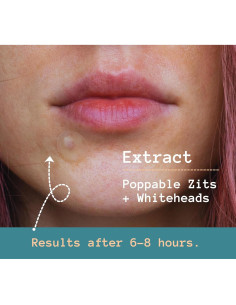 Parche Hidrocoloide para Acné - Ácido Salicílico - 81 Unidades 2