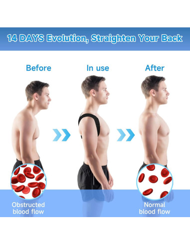 Corrector de Postura Abismat Ajustable para Espalda y Hombros Negro M