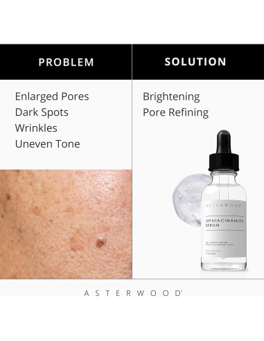 Paquete Suero Niacinamida Asterwood 30 ml + Ojos Ácido Hialurónico