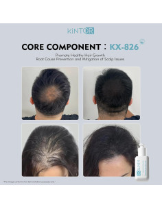 Kintor Spray Bloqueador DHT 0.5% para Crecimiento Cabello 60ml 2