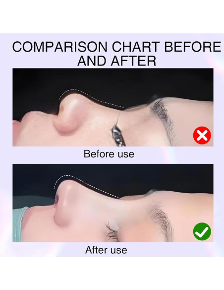 Moldeadores de Nariz Qiyuda 2 Pcs Silicona Acero Inoxidable