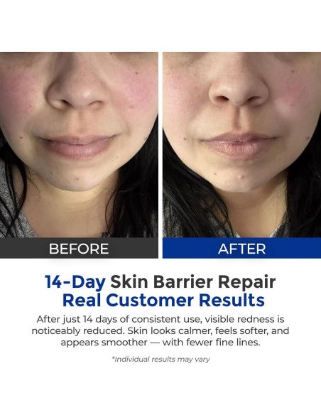 Set de 3 Esencias Skinerse - Sueros Antiarrugas y Calmantes