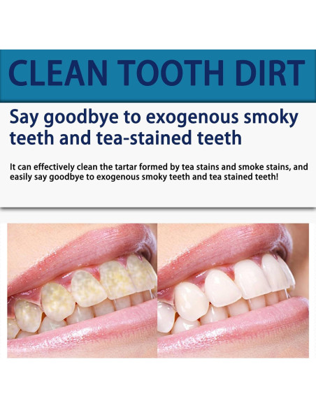 Tiras Blanqueadoras ABYST 16 Ct para Dientes Sensibles