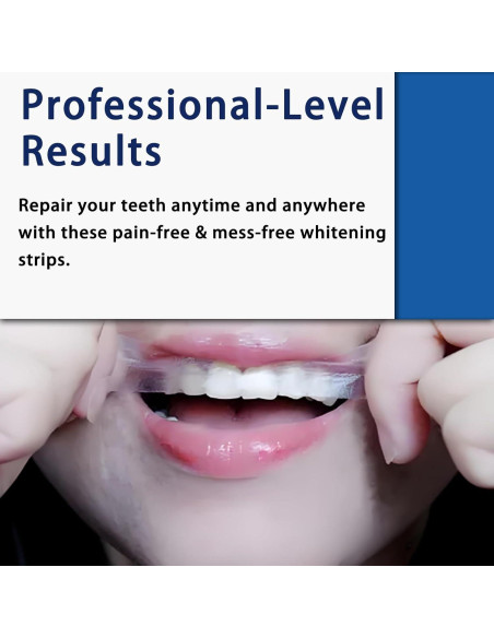 Tiras Blanqueadoras ABYST 16 Ct para Dientes Sensibles