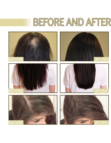 2Pack Aceite Natural Crecimiento Cabello Carvenchi 60ml