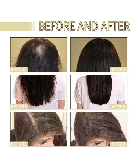 2Pack Aceite Natural Crecimiento Cabello Carvenchi 60ml