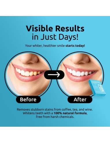 Tiras Blanqueadoras de Dientes Carbon White - 28 Unidades - Sabor Menta