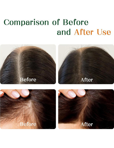 Aceite de Romero Orgánico LABJD 47.6 ml para Crecimiento Cabello