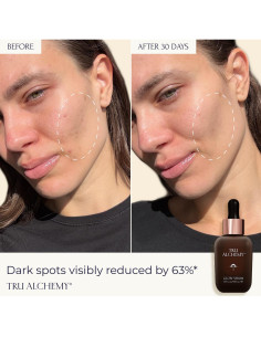 Suero Facial Hidratante Tru Alchemy 29.57 ml - Vitamina C 2