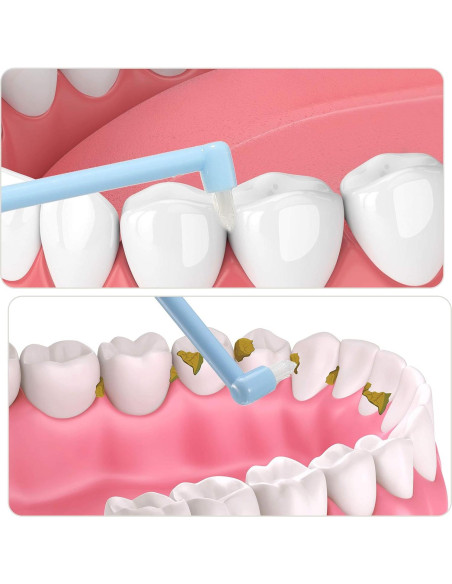 12 Cepillos Interdentales Suaves Patelai con Tapa Protectora