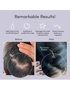 Cepillo Exfoliante Jupiter 600 para Cuero Cabelludo Negro 2