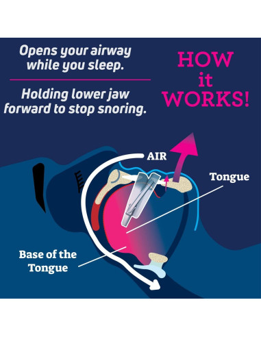 Dispositivo Anti Ronquidos SmartGuard Ajustable 109g
