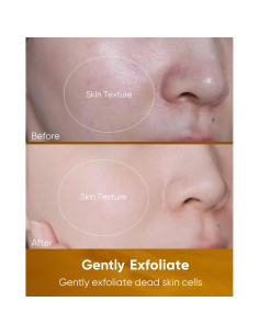 Máquina de Microdermoabrasión KINGDO ND-9004-S 2-en-1 2