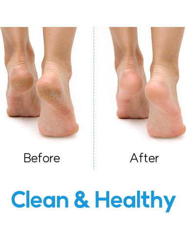 Cepillo Limpiador de Pies DalkomLife con Exfoliador y Masaje