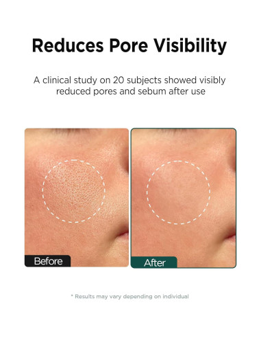 Almohadillas Tónico Facial Veganas ANCORS 60 Pads 160ml