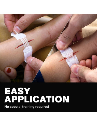 Cierres de Heridas Zip Stitch SurviveX - 3 Piezas