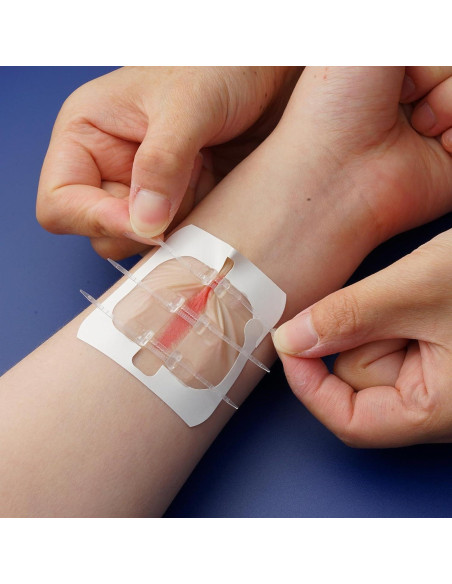 Cinta de Cierre de Heridas FORKANG 6 Cremalleras 6,1x10,4 cm