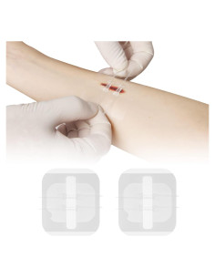 Cierre de Heridas Sin Puntos MaiWieel 2 Piezas 15x10cm