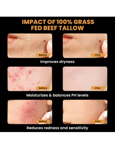 Bálsamo de Sebo y Miel MONIER 175g - Hidratante Natural Piel Sensible