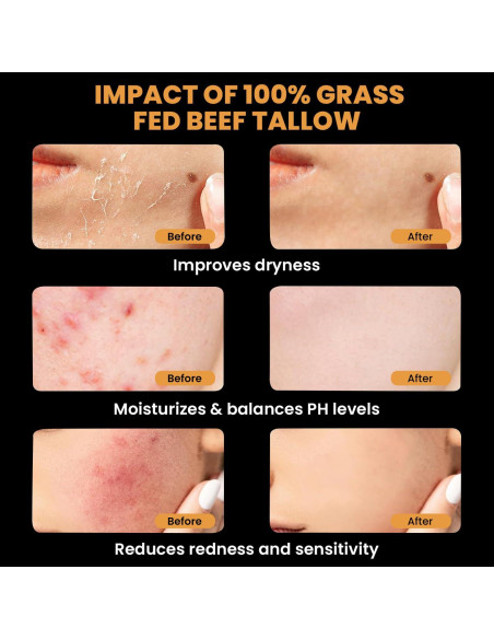 Bálsamo de Sebo y Miel MONIER 175g - Hidratante Natural Piel Sensible